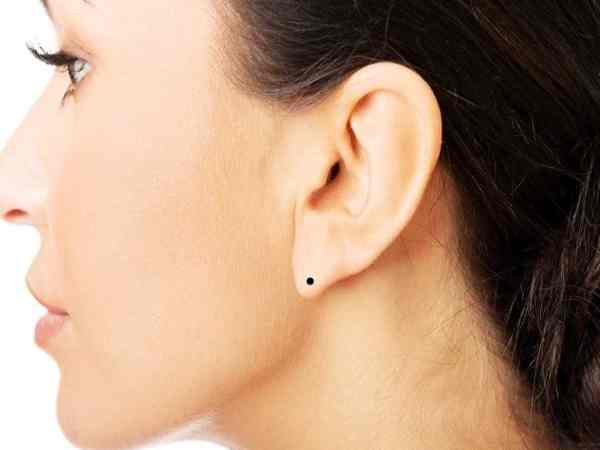 nốt ruồi ở dái tai