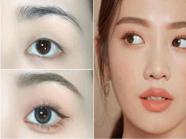 Mắt mí lót là gì? Mắt mí lót là gì?