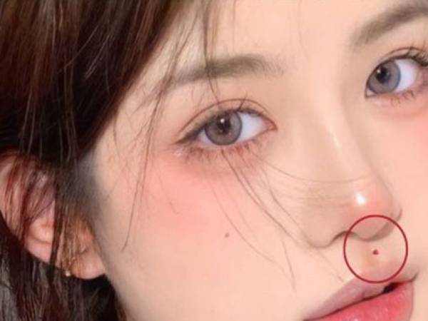 Nốt ruồi ở nhân trung bên phải nữ Nốt ruồi ở nhân trung bên phải nữ